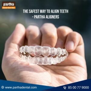 The Magic Braces – Aligners! 2 The Magic Braces – Aligners