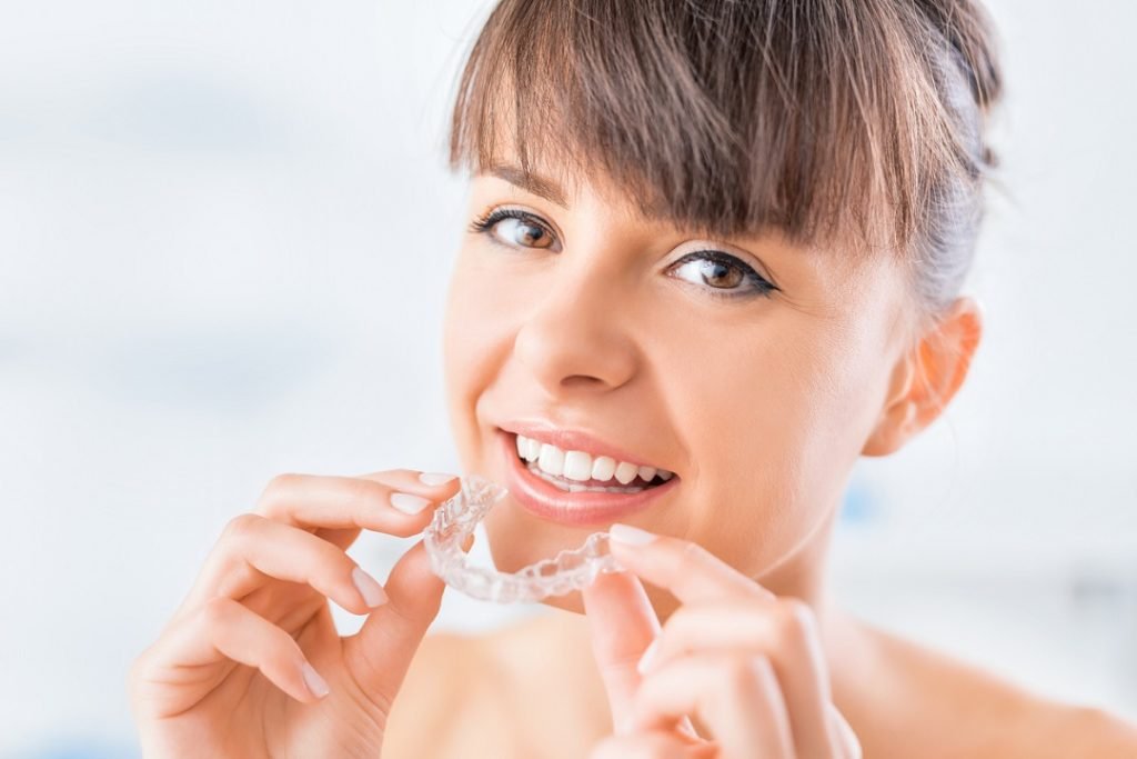 Aligners – Get to know them 2 The Magic Braces – Aligners!
