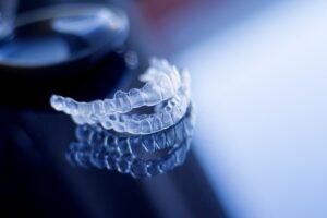 The Magic Braces – Aligners! 3 The Magic Braces – Aligners
