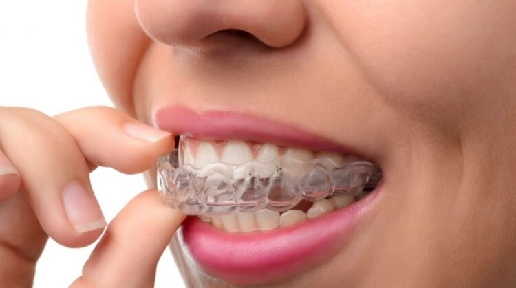 Do You Have a Problem With Your Smile? 1 Have a Problem With Your Smile