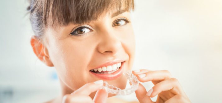 Aligners – The Magic Braces