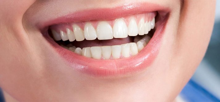 3 ways to replace lost teeth at partha dental