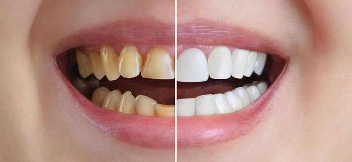 At Partha Dental – we do both cosmetic and aesthetic dentistry 1 cosmetic and aesthetic dentistry