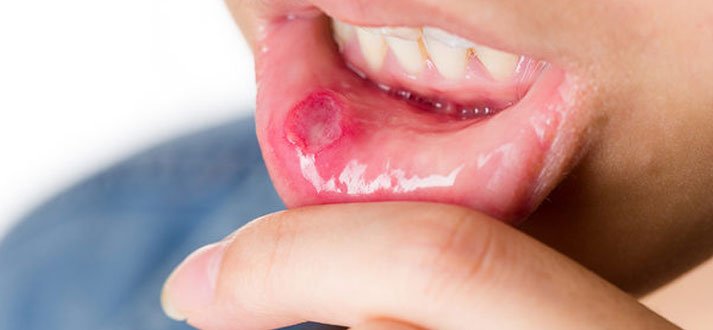 Hospital for Mouth Cancer Surgery and Treatment 1