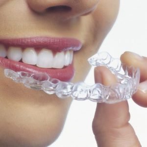 Adult Aligners for crooked teeth! 2 invisible aligners