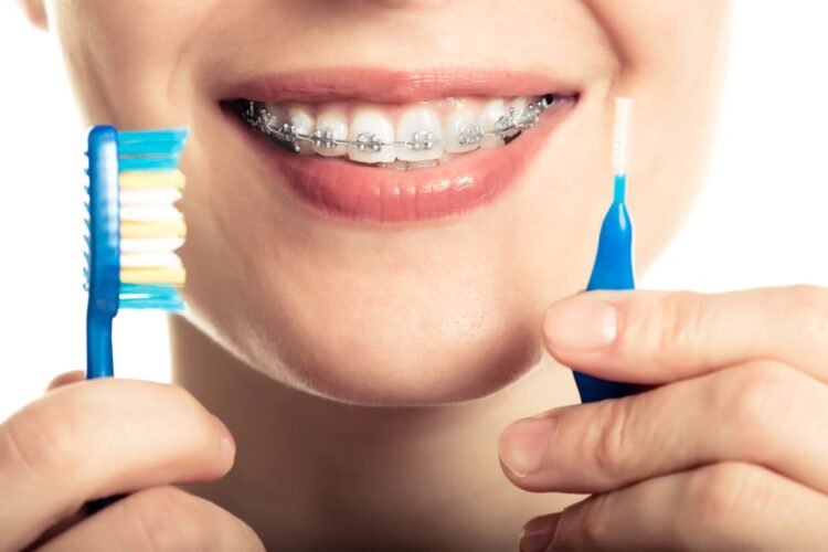 Keep Your TeethBraces Clean And Hygienic