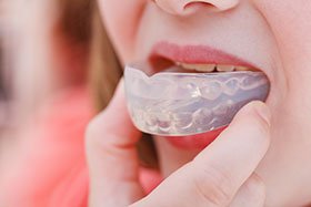 Sleep Apnea- How your Dentist can help 2 sleep apnea