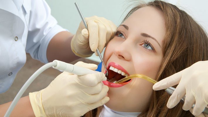 6 Myths About Teeth Scaling (Teeth Cleaning) 1 tooth scaling