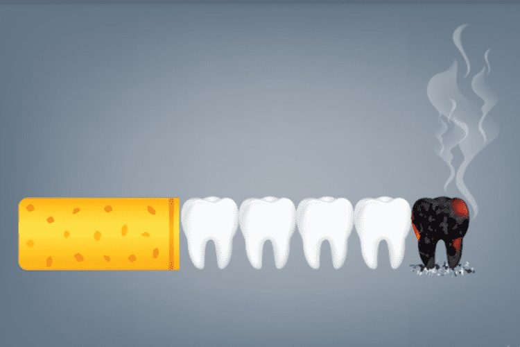 smoking and your teeth