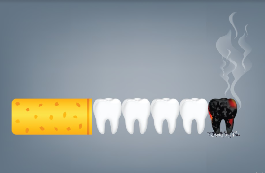 smoking and your teeth