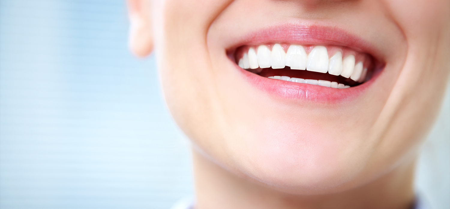 Chipped Teeth treatment