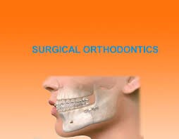jaw surgery
