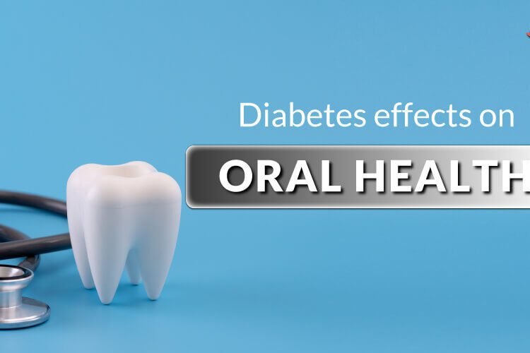 Diabetes And Dental Care: Guide To A Healthy Mouth 1 diabetes a chronic disease