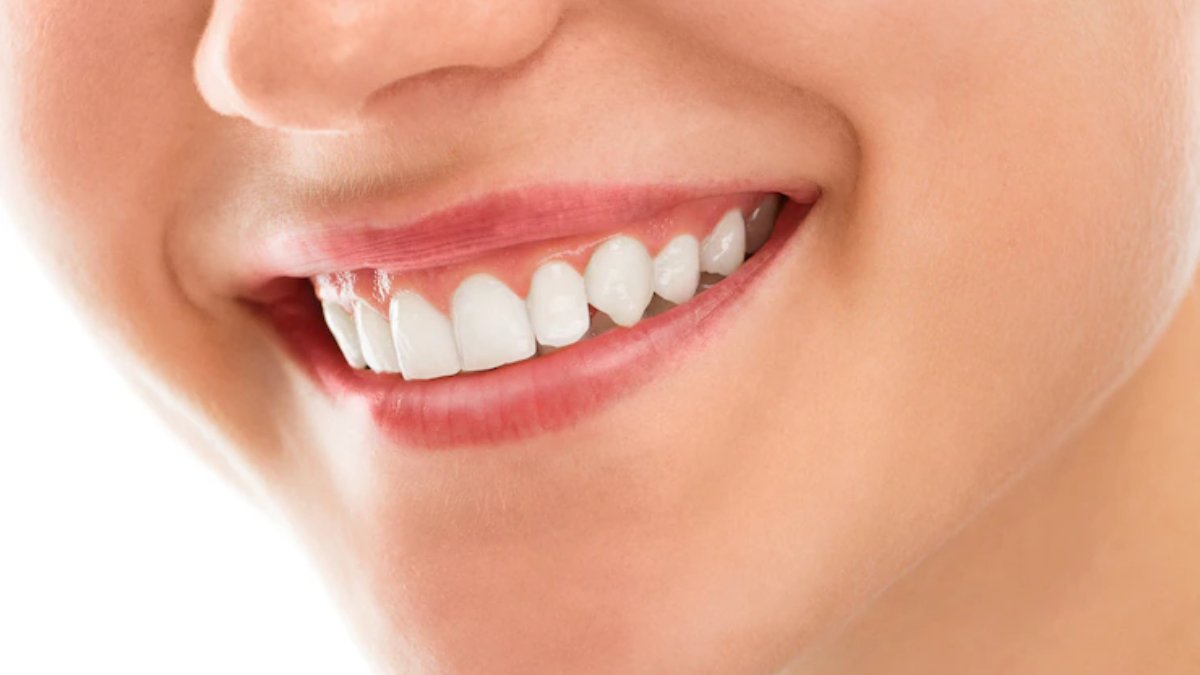 Cavity removing - fillig treatment