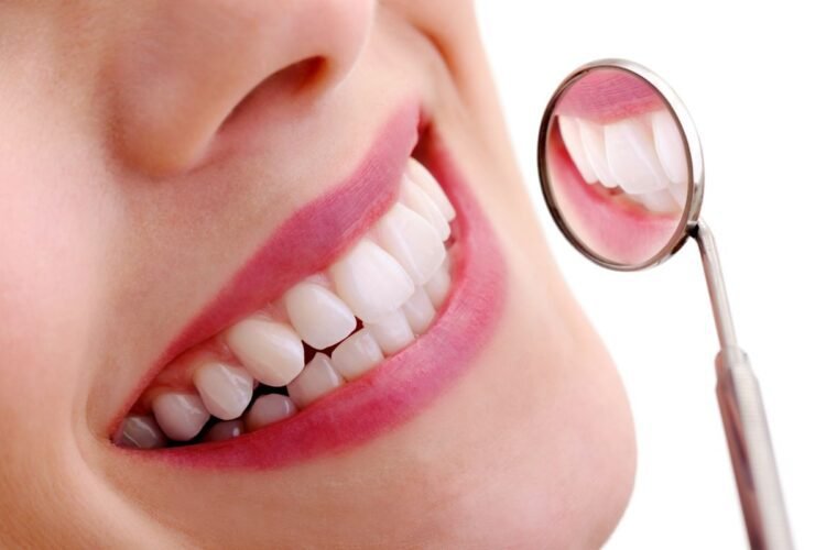 Dental Veneers tratment