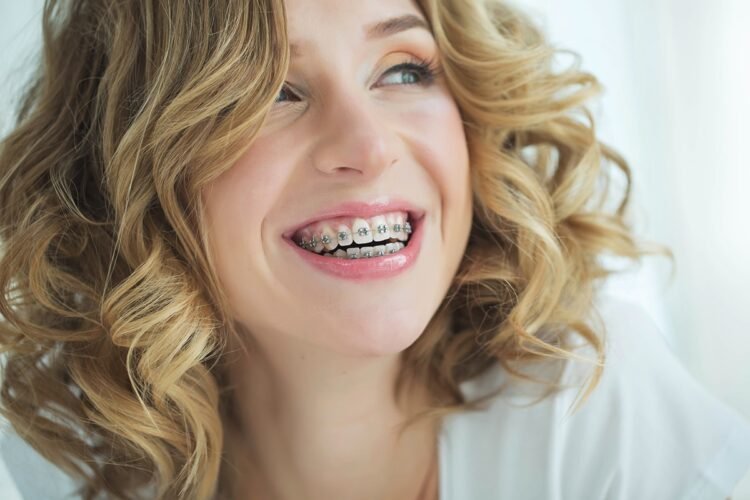 4 Reasons To Get Adult Braces 1 Tooth braces - treatment