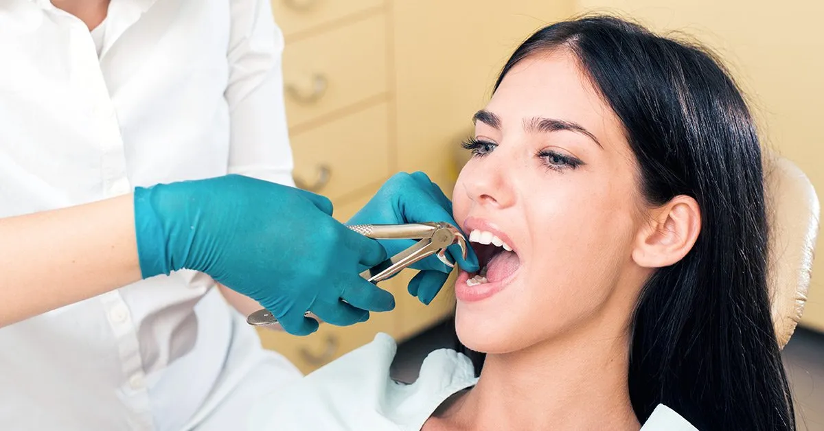 tooth extraction