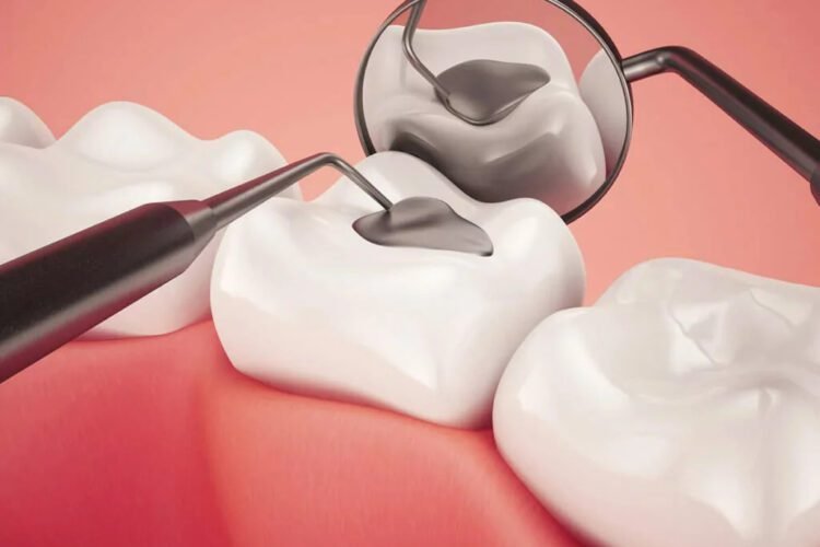 tooth filling