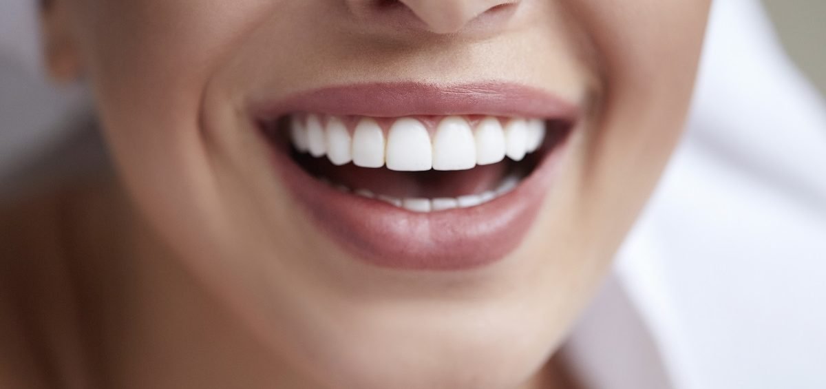 teeth Whitening