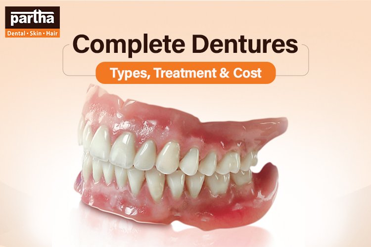 Complete Dentures: Types, Treatment and Cost in Hyderabad 1 Complete Dentures