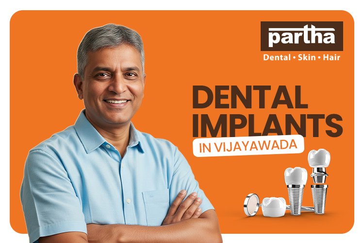 Dental Implants in Vijayawada: Diagnosis, Types, Cost, Procedure & Benefits 1 DENTAL IMPLANTS VIJAYAWADA