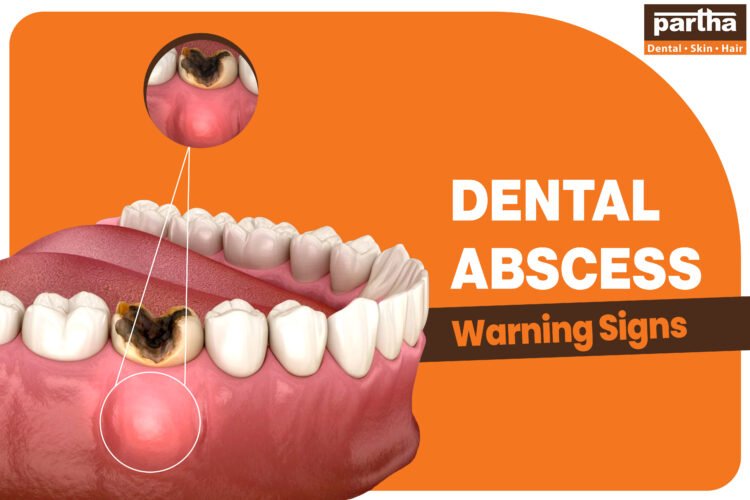 Dental Abscess Treatment: What You Need to Know About the Warning Signs and Cost 1 Dental Abscess Warning Signs 2