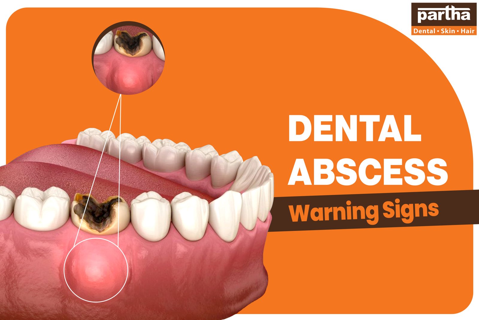 Dental Abscess Warning Signs 2 scaled