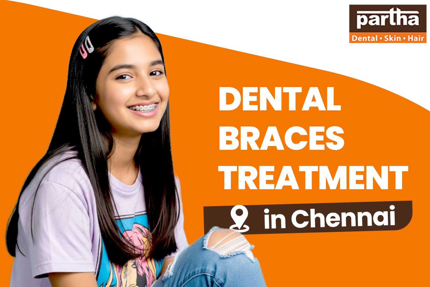 Dental braces 750 500 3