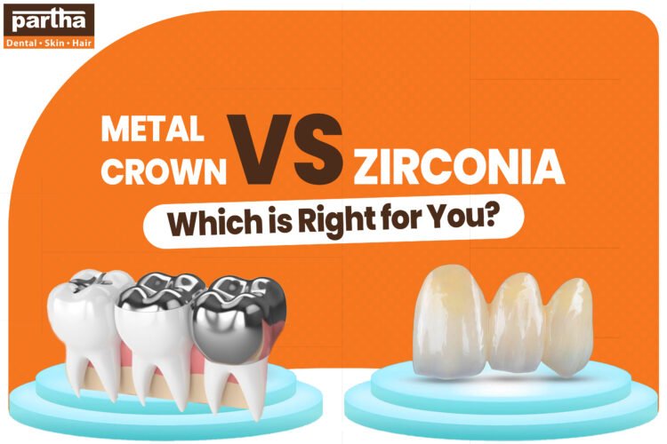Metal Crown vs Zirconia – Choosing the Right Aesthetic 1 Metal Vs Zirconia 1