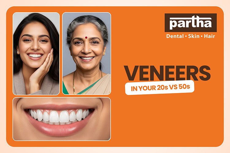 Veneers at 20 vs 50: How Age Affects Your Cosmetic Choices 1 PARTHA DENTAL BLOG IMAGE 08 750X500