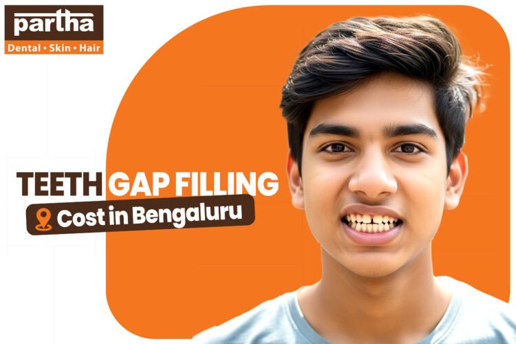 Teeth Gap Filling