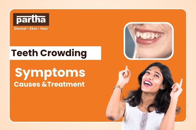 teeth Crowding