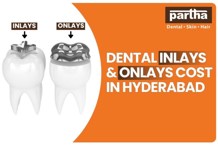 Dental Inlays and Onlays Cost in Hyderabad – A Full Guide from Partha Dental 1 inlays onlays